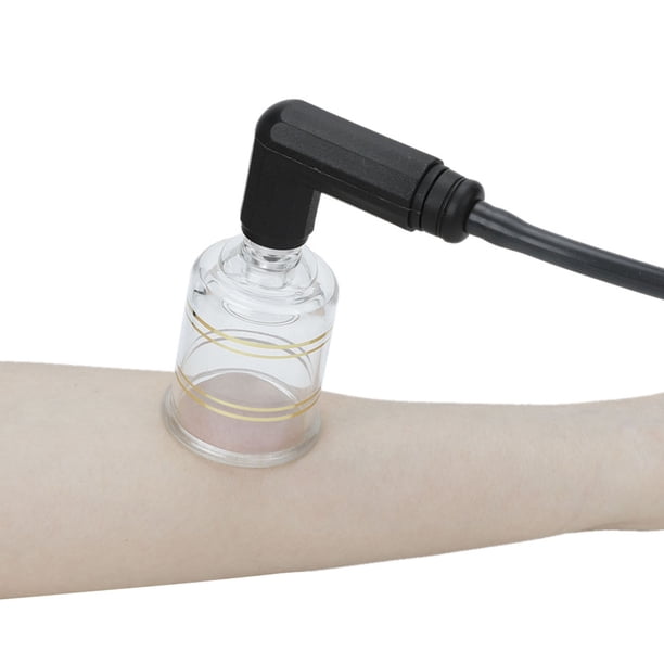 JUEGO DE VENTOSAS CHINAS, 24 VENTOSAS DE AIRE AL VACVÍ, JUEGO DE