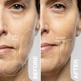 thumbnail image 5 of Dispositivo de depilación antienvejecimiento Dermaflash LUXE Plus, 5 of 5