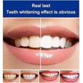 thumbnail image 3 of Sp-4 Probiotic Toothpaste Removal Of Plaque Stains Decay Repair Of Cavities Caries Repair Whitening Yellowing, 3 of 4