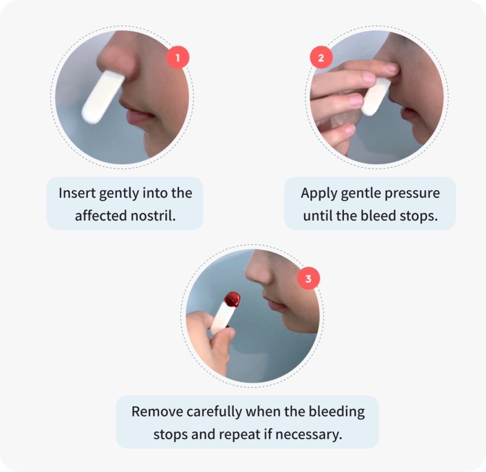 Nampons™ Kids for Nosebleeds - 12 Fast Nosebleed Stoppers with Hypoallergenic Clotting Agent