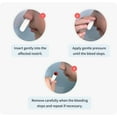 thumbnail image 5 of Nampons™ Kids for Nosebleeds - 6 Small Nosebleed Stoppers with Hypoallergenic Clotting Agent to Stop Nosebleeds Fast, 5 of 9