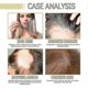 thumbnail image 2 of 3pcs Eganic Natural Hair Growth Oil,veganic Hair Growth Oil,veganic Hair Oil For Dry Damaged Hair, 2 of 3