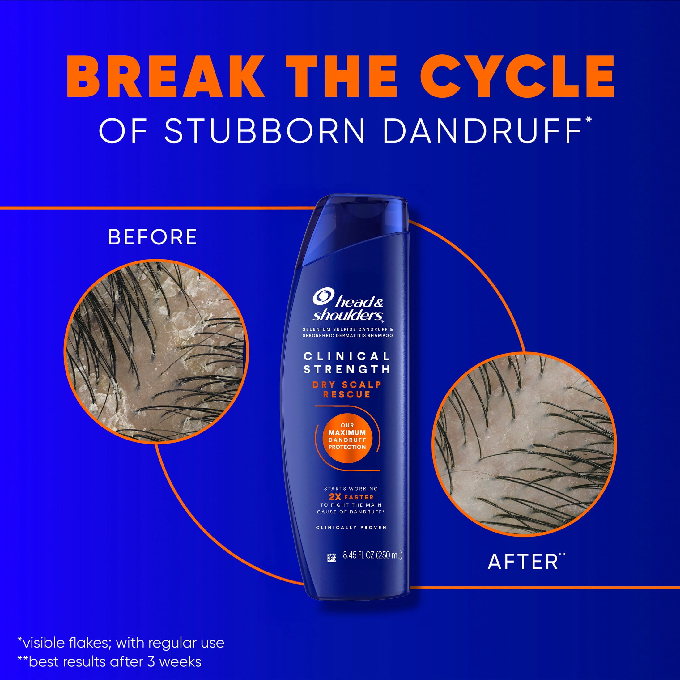 Head and Shoulders Dandruff Shampoo, Clinical Strength Dry Scalp Rescue, with 1% Selenium Sulfide, 8.45 fl oz