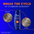 thumbnail image 4 of Head and Shoulders Clinical Strength Dry Scalp Rescue Shampoo, for Stubborn Dandruff, 8.45 fl oz, 4 of 7