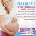 thumbnail image 6 of Scar Repair Cream for Old & New Scars – Helps Improve Appearance from Cuts, Stretch Marks, C-Sections & Surgeries, 1.7 oz, 6 of 10