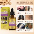 thumbnail image 4 of Aceite esencial para el cabello HUOGUO Ginger Essence para el crecimiento del cabello, 30 ml, 4 of 5