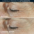 thumbnail image 5 of RoC Derm Correxion Dual Eye Cream with Retinol + Peptides for Puffy Eyes &Dark Circles, 0.68 oz, 5 of 12