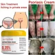 thumbnail image 4 of Pomada especial antibacteriana para psoriasis, tratamiento de musgo rebelde, psoriasis corporal y muslo, dermatosis, picazón, eczema, 4 of 5