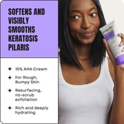 Amlactin KP Bumps Be Gone Cream, 3 oz