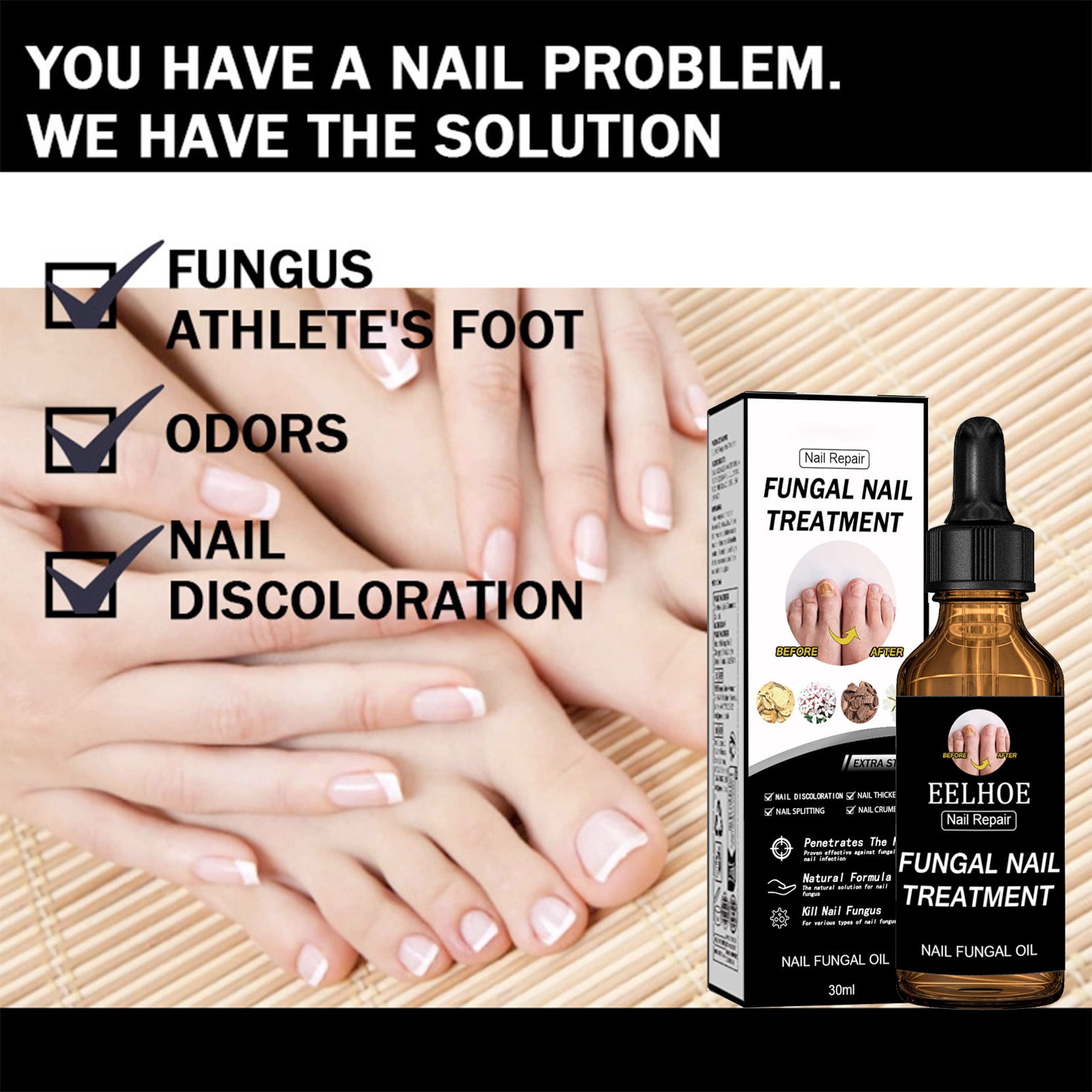 Alvantor Nail Fungus Treatment, Nail Repair Oil Moisturizing and Daily Care, 1fl.oz