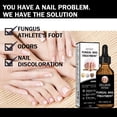 thumbnail image 3 of Alvantor Nail Fungus Treatment, Nail Repair Oil Moisturizing and Daily Care, 1fl.oz, 3 of 7