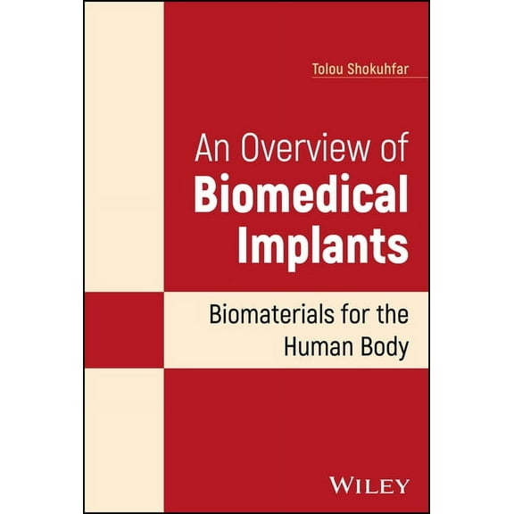 An Overview of Biomedical Implants: Biomaterials for the Human Body, (Hardcover)