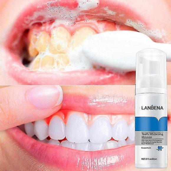 Teeth Whitening Mousse Remove Plaque Stains Bleach Dental Tools Clean Fresh Breath Oral Hygiene Teeth Whitener Products Tw--
