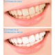 thumbnail image 4 of Soidarity 40 piezas Micro cepillo aplicador de dientes palo Mini cepillo de dientes de nailon Oficina escuela viaje herramienta de limpieza cuidado de los oídos 4 colores, 4 of 6