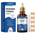 thumbnail image 1 of Solución suavizante YYNRHJ para uñas encarnadas, 30 ml, 1 of 6