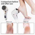 thumbnail image 4 of Electric Callus Remover with Digital Display & Vacuum Suction, Rechargeable Foot Scrubber for Home Spa & Travel White/, 4 of 5