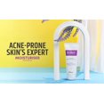 thumbnail image 4 of Gel crema hidratante Brinton Acmist para piel grasa y con tendencia al acné, 4 of 6