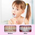 thumbnail image 4 of Cepillo de dientes infantil en forma de U (con estuche), cepillo de dientes infantil en forma de U, limpieza bucal 360° y blanqueamiento dental - Rosa, 4 of 5