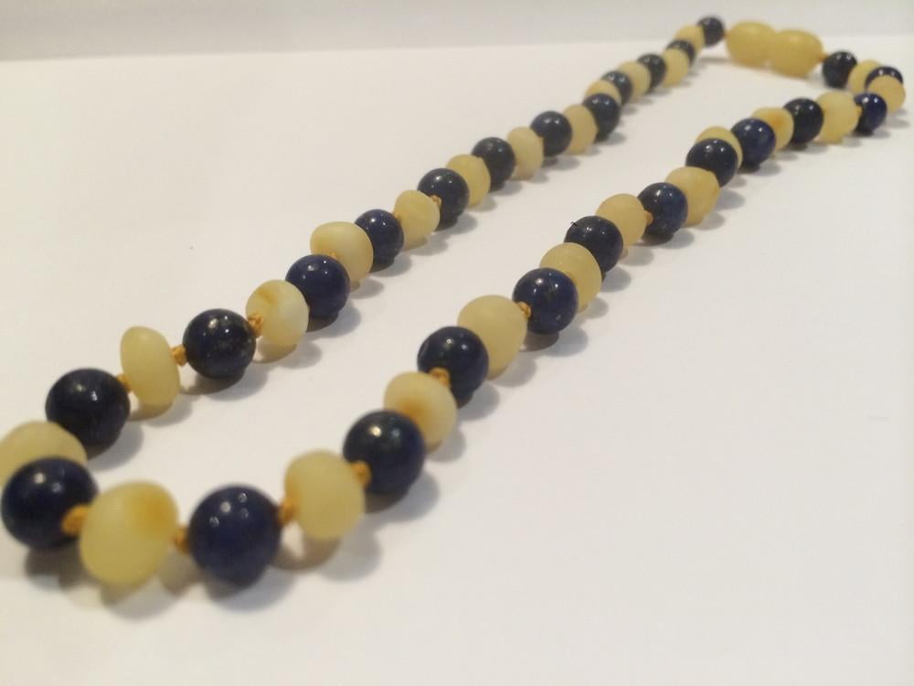 amber necklace for anxiety