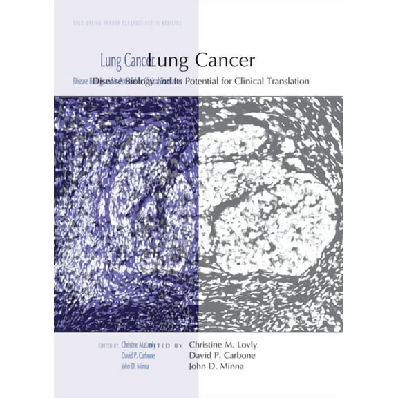Perspectives Cshl Lung Cancer: Disease Biology and Its Potential for Clinical Translation, (Hardcover)