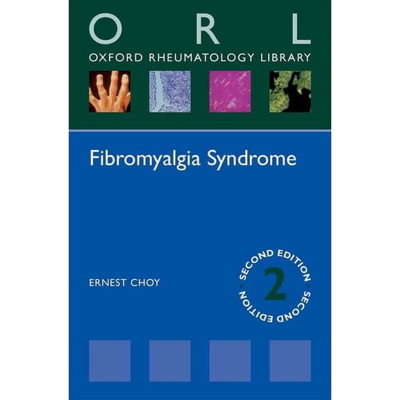 Oxford Rheumatology Library Fibromyalgia Syndrome, (Paperback)