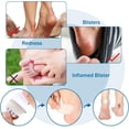 thumbnail image 3 of Hydrocolloid Bandage for Heel Protection Skin Waterproof 150 Pieces Oval Blister Pads, 3 of 5