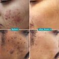thumbnail image 4 of Pilgrim 10% Niacinamide Face Serum With 1% Zinc PCA, 30ml, 4 of 5