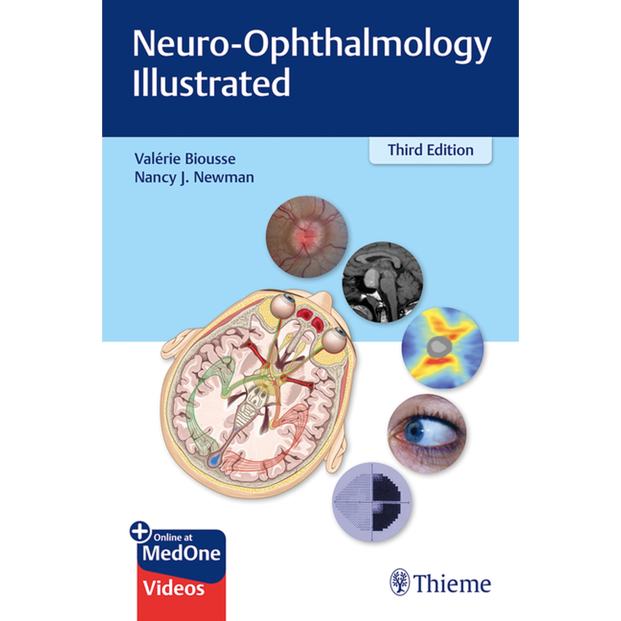 Neuro-Ophthalmology Illustrated, (Paperback)