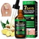 thumbnail image 5 of Nail Fungus Treatment, Ginger Nail Fungus Treatment, Toenail Cuticle Care Oil Care, Fungal Nail Treatment, 7 Days Nail Fungus Treatment for Toenail, 5 of 5