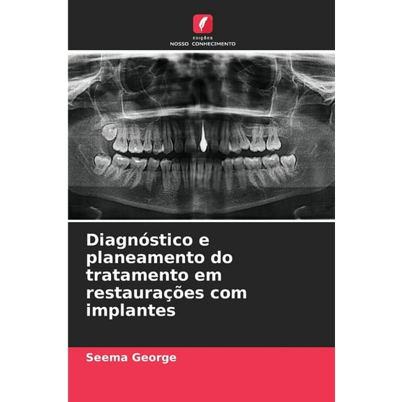 DiagnÃ³stico e planeamento do tratamento em restauraÃ§Ãµes com implantes, (Paperback)