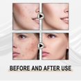thumbnail image 5 of Líquido exfoliante suave con ácido lactobiónico de Jaysuing, para puntos negros y limpieza profunda - Código de producto 31685, 5 of 5