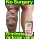 thumbnail image 2 of Esencia para el cuidado de la piel de las piernas, 2 of 5