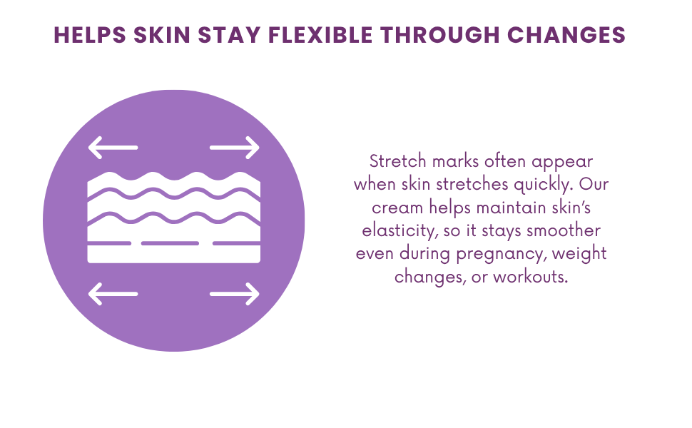 Michelle Marques Stretch Mark Cream – Pregnancy Safe, Hypoallergenic Formula with Almond Oil & Chamomile for Hydration and Elasticity (5.29 oz)