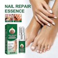 thumbnail image 3 of Nail Repair Essence Fungus Treatment Anti Fungal Infection For Toe Nail Nail, 3 of 5
