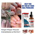thumbnail image 5 of Nail Repair Liquid Hand And Foot Grey- Nail Care Repairing The Thickened Soft Nail Of Grey- Nail Liquid 30ml, 5 of 5