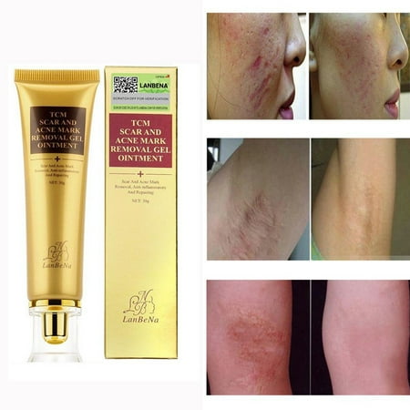 Scar Acne Mark Removal Gel Face Pore Skin Repair Stretch Marks Cream (Best Cream For Scar Removal On Face)