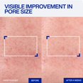 thumbnail image 3 of Serum IOPE Expert Retinol RX 1% Super Bounce 30 mL, 3 of 8