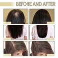 thumbnail image 5 of Sérum para el crecimiento del cabello 60 ml para cabello fino y tratamiento anticaída con nutrición profunda., 5 of 5