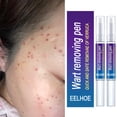 thumbnail image 3 of 2 uds removedor de verrugas pluma para etiquetas de piel papilomas eliminación de lunares herramientas de punto indoloras Sywqhk Cuidado Belleza, 3 of 7