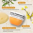 thumbnail image 2 of Crema de tratamiento para eliminar el acné TTLALA con 2% de ácido salicílico, 2 of 8