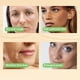 thumbnail image 4 of Esencias de aceite de retinol, suero para el cuidado de las ojeras y las bolsas, cuidado de la piel contra las ojeras, suero para reducir las bolsas de los ojos, cuidado para hombres y mujeres, 30 ml, 4 of 9