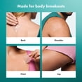 thumbnail image 4 of Hero Cosmetics Mighty Patch Body – The XXL Hydrocolloid Patch for Large Breakout Areas, Suitable for Sensitive Skin, 4 Count, 4 of 7