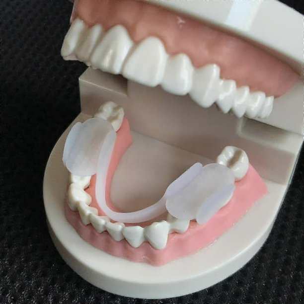 2 protectores bucales para bruxismo, férula para dormir, aparatos dentales para apretar los dientes, entrenador de alineación, ayuda para dormir, protector dental, herramientas_FC31
