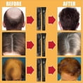thumbnail image 2 of Loción para cabello largo y espeso con bola de rodillo de masaje Eelhoe -3122820341280, 2 of 5