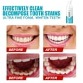 thumbnail image 4 of Pasta dental blanqueadora, enjuague bucal de 60 ml, blanqueamiento dental, espuma blanqueadora, pasta dental para blanquear los dientes, pasta dental de viaje, espray de jengibre., 4 of 5