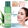 thumbnail image 3 of Gel Hidratante De Aloe Vera Gel Hidratante De Aloe Vera Crema Facial Gel De Belleza Crema Para El Cuidado De La Piel 120 Ml Hidratante Gel De Aloe Vera Hidratante Crema Para El ANGGREK AHX1348, 3 of 8
