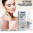 thumbnail image 2 of Jaysuing lactobionic acid liquid deeply cleanses, gently removes blackheads, exfoliates, shrinks pores and moisturizes the skin | |, 2 of 5