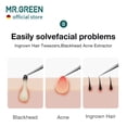 thumbnail image 3 of MR.GREEN Ingrown Hair Tweezers Needle Nose Pointed Tips Tweezers For Eyebrows Splinters Blackhead Removal Acne Clip Extractor (Short), 3 of 7