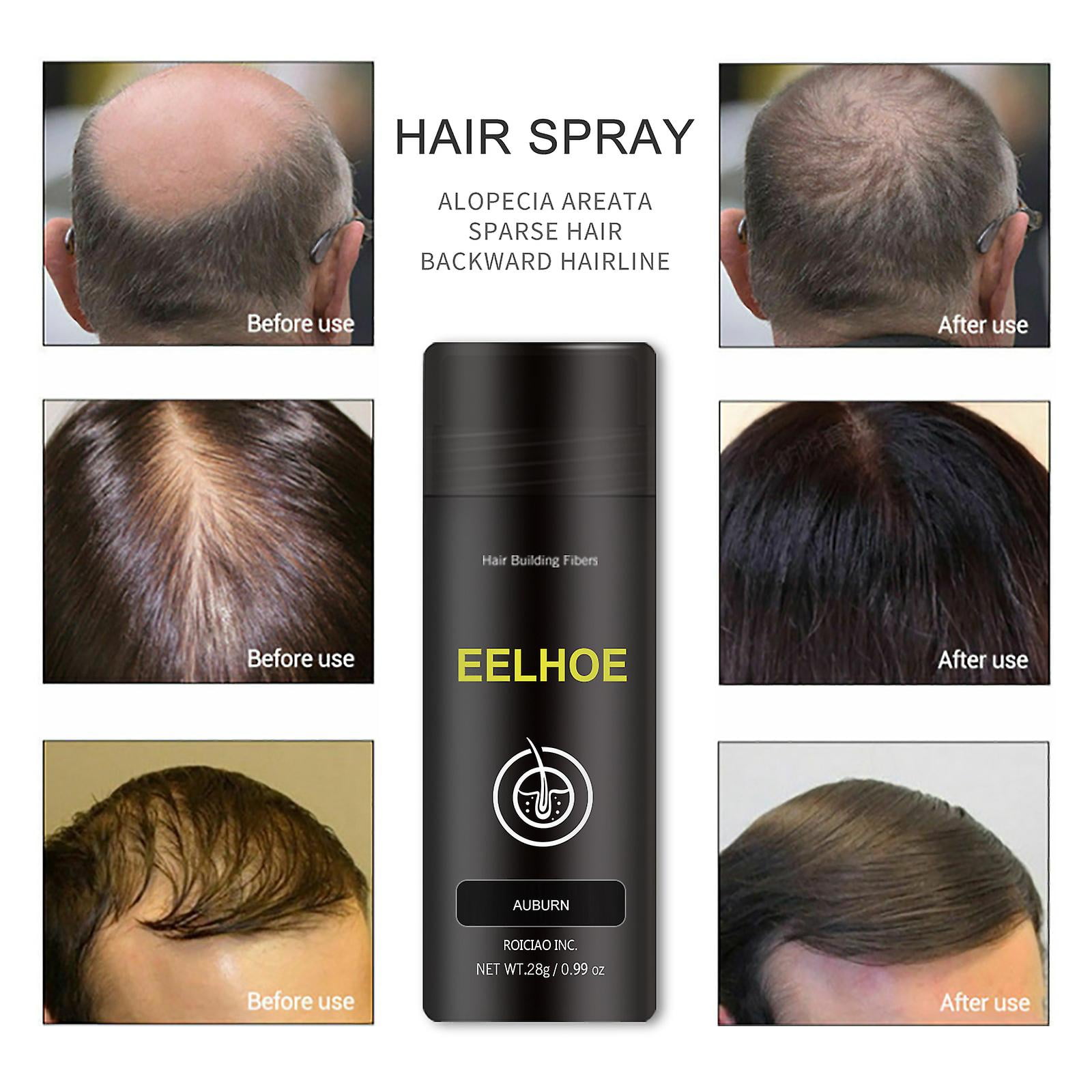 Eelhoe Hair Volume Fiber Powder Dense Hair Powder Spray Dyeing Dense Hair  Replacement Hairline--eelhoe Auburn-yunbice0 | Walmart Canada