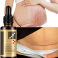 thumbnail image 2 of Scar Removal Lavender Cream For , Stretch Marks, Burn Skin Bio Regulation, Nourishing, 2 of 8
